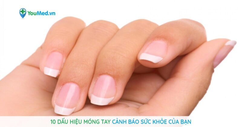 Hinh anh mong tay binh thuong co mau gi voi sac do hong hao